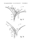 DEVICES, SYSTEMS AND METHODS FOR ENCLOSING AN ANATOMICAL OPENING diagram and image