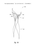 DEVICES, SYSTEMS AND METHODS FOR ENCLOSING AN ANATOMICAL OPENING diagram and image