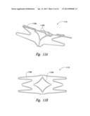 DEVICES, SYSTEMS AND METHODS FOR ENCLOSING AN ANATOMICAL OPENING diagram and image