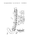 BONE FIXATION SYSTEM WITH OPPOSED MOUNTING PORTIONS diagram and image