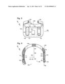 BONE FIXATION SYSTEM WITH OPPOSED MOUNTING PORTIONS diagram and image