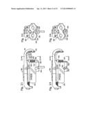 BONE FIXATION SYSTEM WITH OPPOSED MOUNTING PORTIONS diagram and image