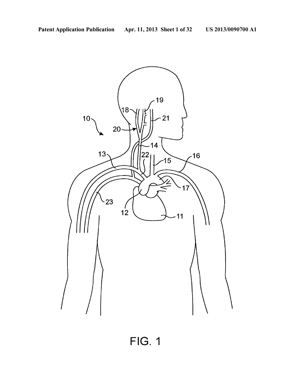 ELECTRODE STRUCTURES AND METHODS FOR THEIR USE IN CARDIOVASCULAR REFLEX     CONTROL - diagram, schematic, and image 02