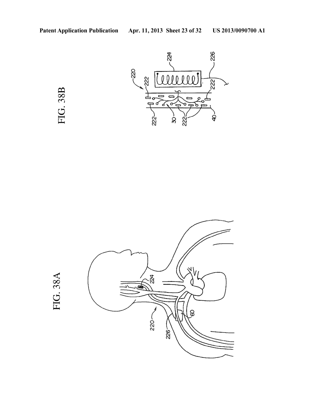 ELECTRODE STRUCTURES AND METHODS FOR THEIR USE IN CARDIOVASCULAR REFLEX     CONTROL - diagram, schematic, and image 24