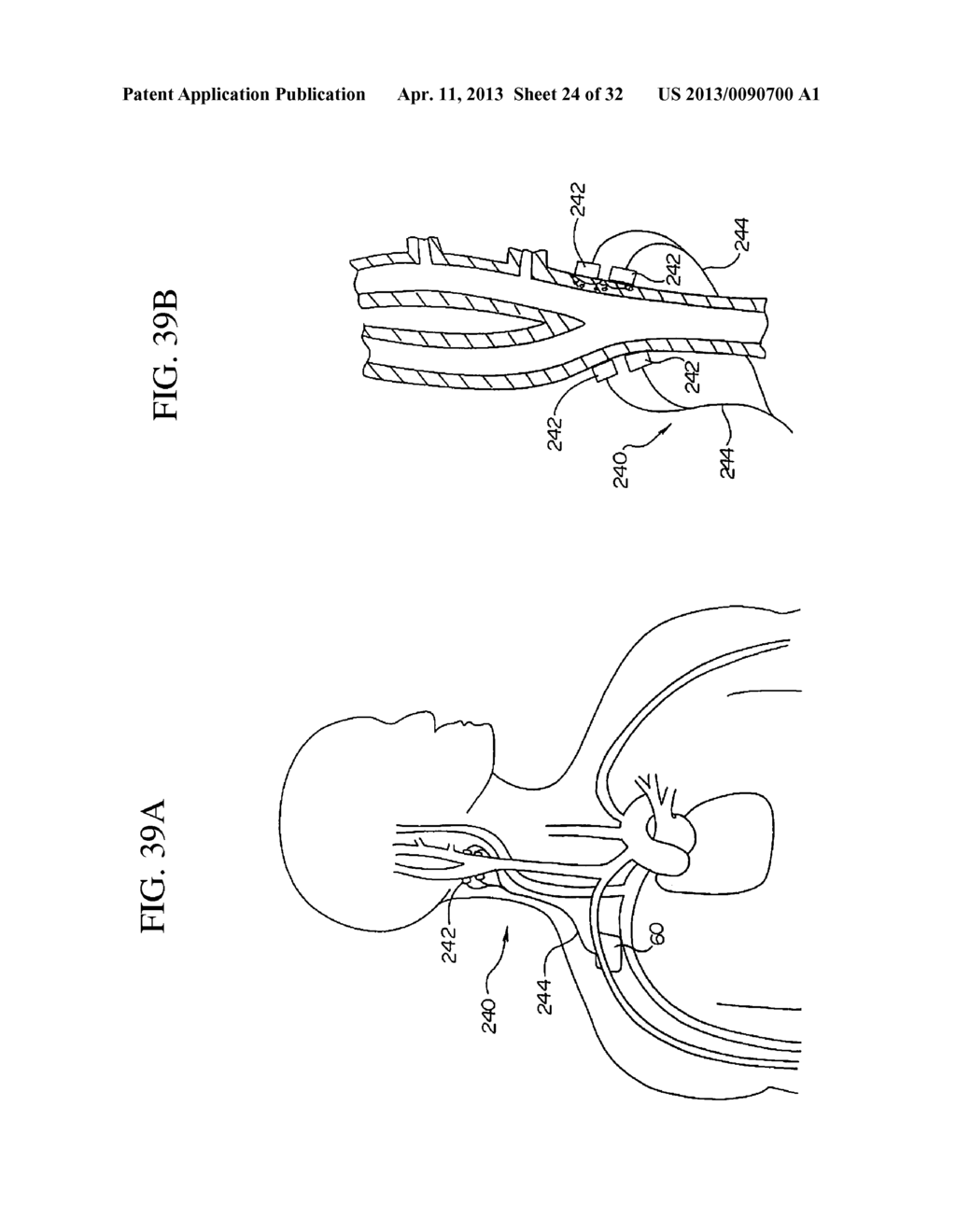 ELECTRODE STRUCTURES AND METHODS FOR THEIR USE IN CARDIOVASCULAR REFLEX     CONTROL - diagram, schematic, and image 25