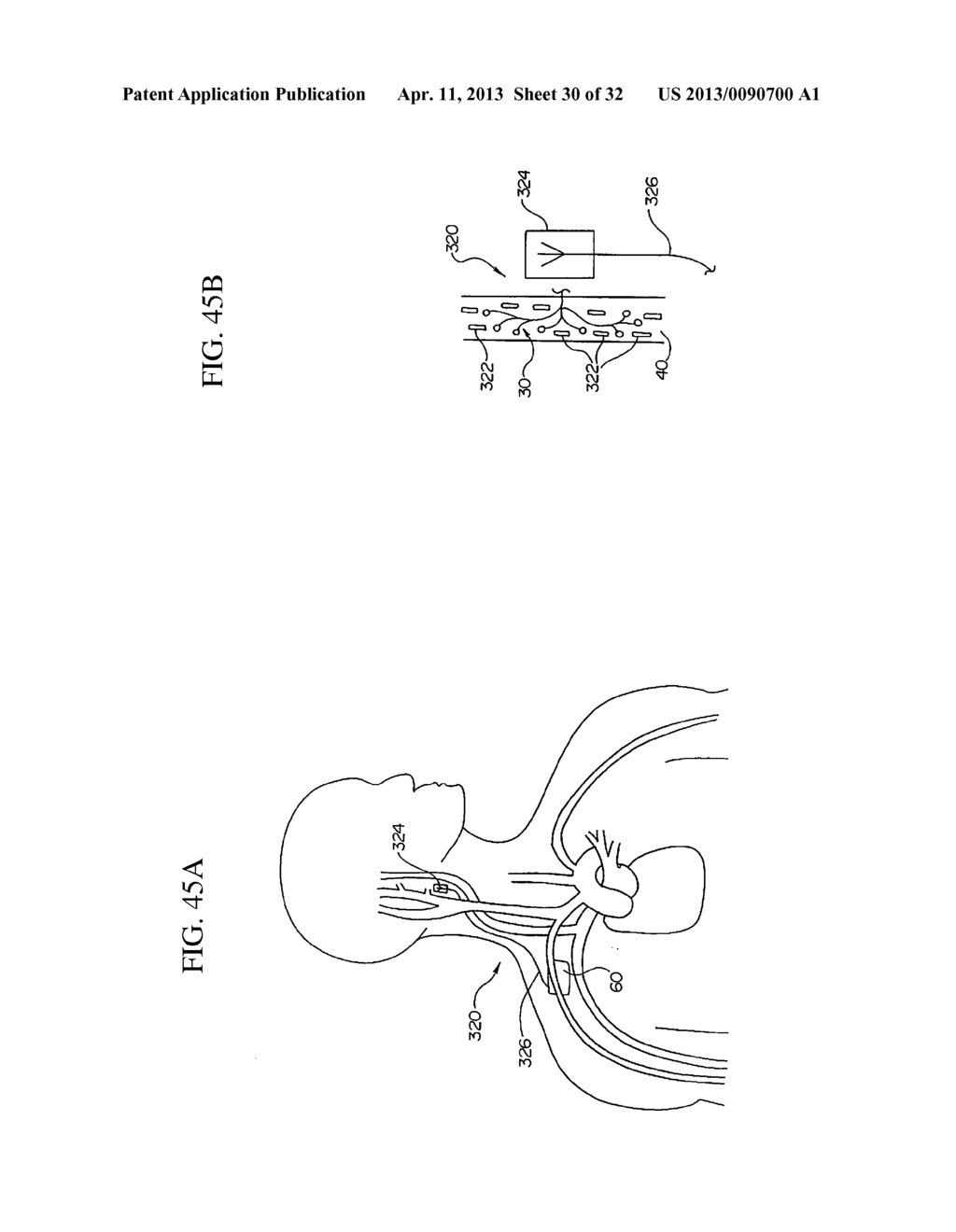 ELECTRODE STRUCTURES AND METHODS FOR THEIR USE IN CARDIOVASCULAR REFLEX     CONTROL - diagram, schematic, and image 31