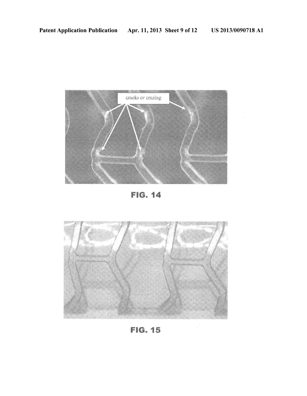 RADIALLY EXPANDABLE POLYMER PROSTHESIS AND METHOD OF MAKING SAME - diagram, schematic, and image 10