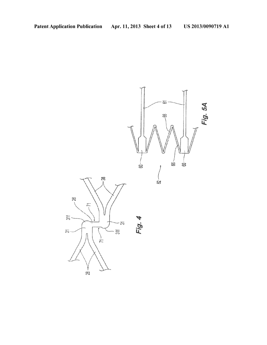 Highly Flexible Stent and Method of Manufacture - diagram, schematic, and image 05