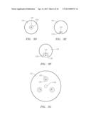 Methods and Devices for Delivery of Prosthetic Heart Valves and Other     Prosthetics diagram and image