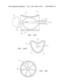 Methods and Devices for Delivery of Prosthetic Heart Valves and Other     Prosthetics diagram and image