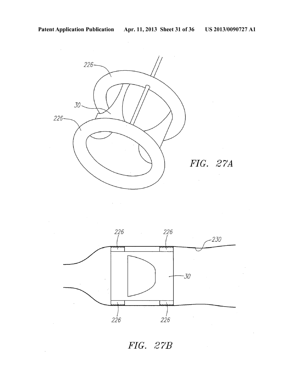 Methods and Devices for Delivery of Prosthetic Heart Valves and Other     Prosthetics - diagram, schematic, and image 32