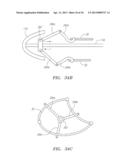 Methods and Devices for Delivery of Prosthetic Heart Valves and Other     Prosthetics diagram and image