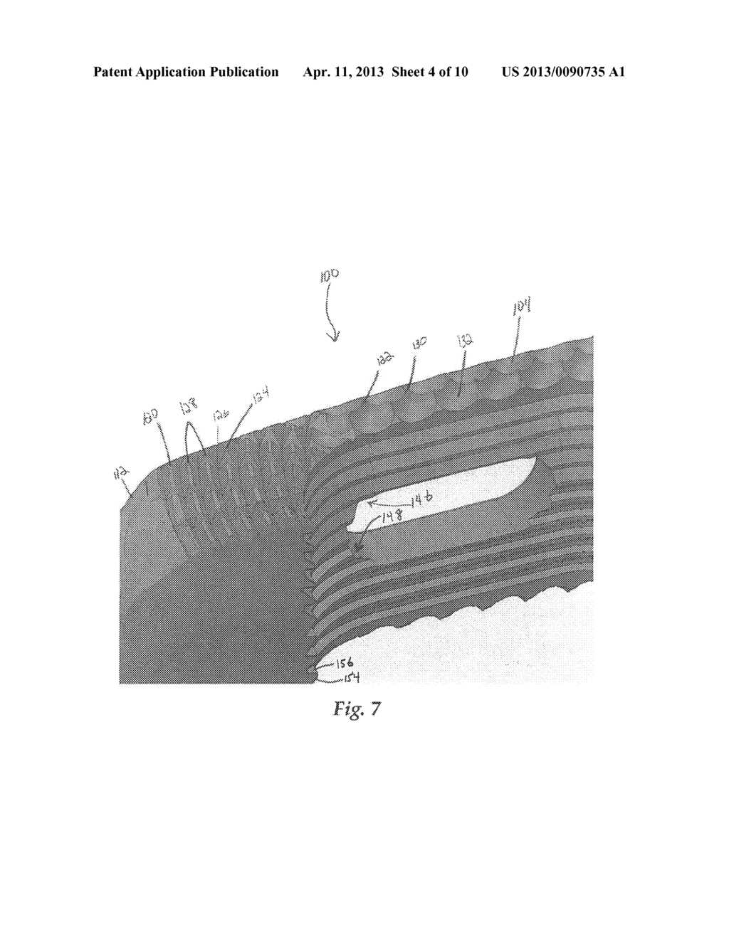 Intervertebral Implant - diagram, schematic, and image 05