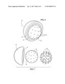 IMPLANTABLE ANKLE JOINT ASSEMBLY WITH SPHERICAL INTER-SUPPORT diagram and image