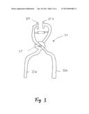 EXPANDABLE MEDICAL IMPLANT diagram and image