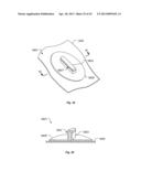 System for Mounting Objects to Polymeric Membranes diagram and image