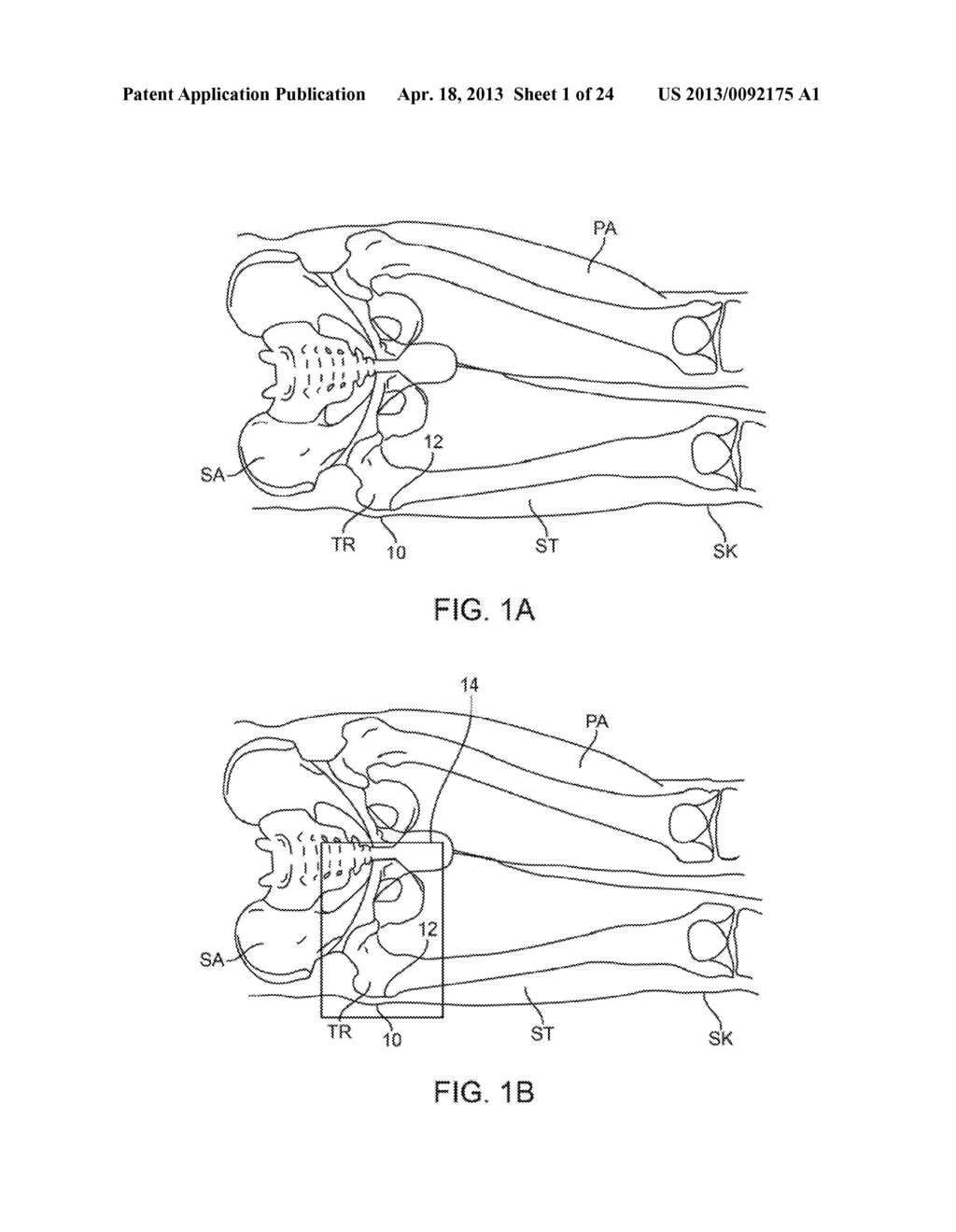 APPARATUS AND METHODS FOR ADJUSTING A SUPPORT TO A BODY - diagram, schematic, and image 02