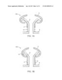 Expander Ear Tip diagram and image