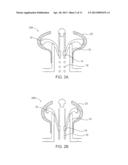 Expander Ear Tip diagram and image