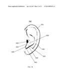 Expander Ear Tip diagram and image