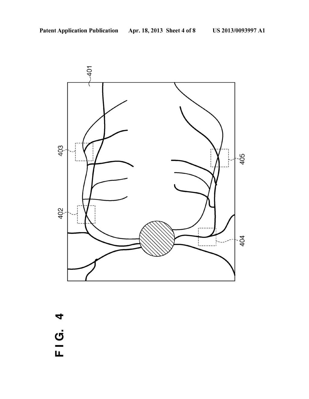 OPTICAL COHERENCE TOMOGRAPHY AND METHOD THEREOF - diagram, schematic, and image 05