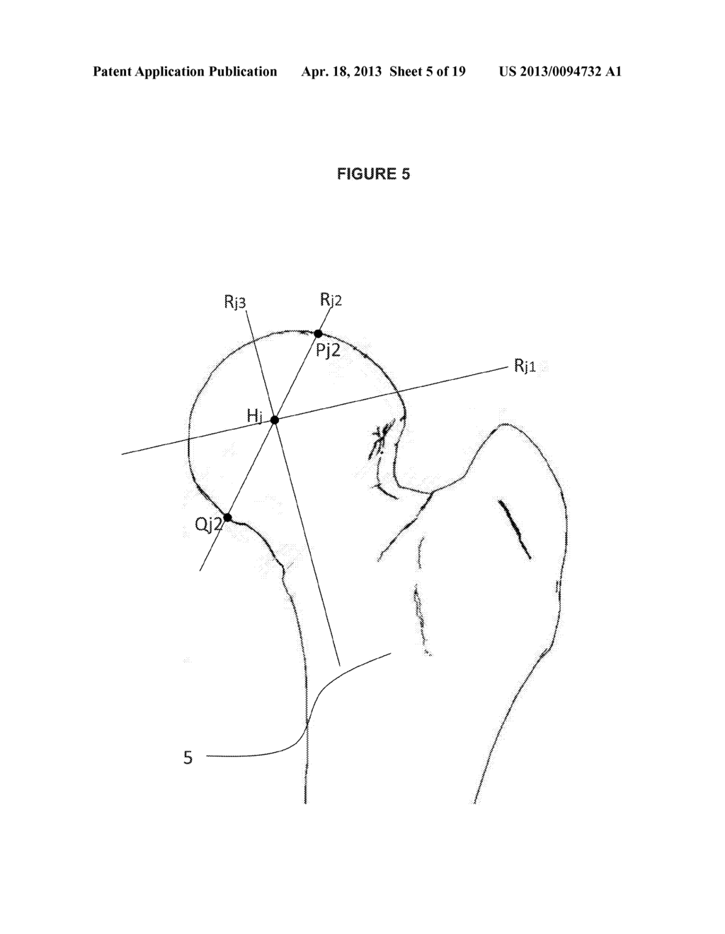 METHOD AND SYSTEM OF AUTOMATIC DETERMINATION OF GEOMETRIC ELEMENTS FROM A     3D MEDICAL IMAGE OF A BONE - diagram, schematic, and image 06