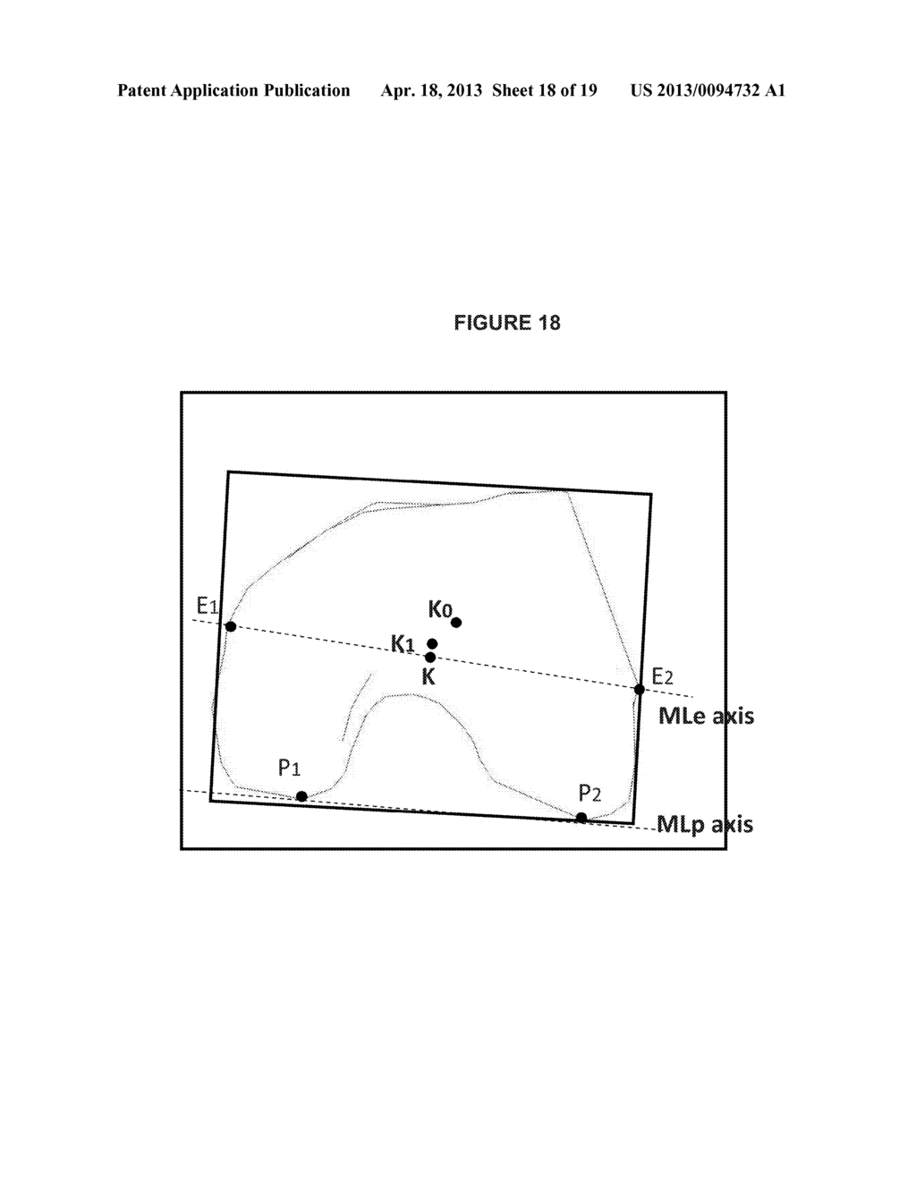 METHOD AND SYSTEM OF AUTOMATIC DETERMINATION OF GEOMETRIC ELEMENTS FROM A     3D MEDICAL IMAGE OF A BONE - diagram, schematic, and image 19