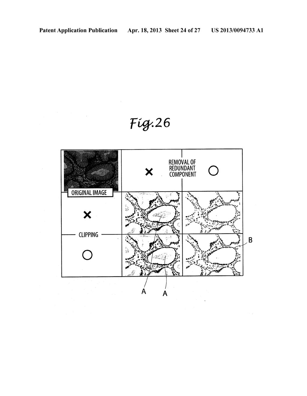 REGION SEGMENTED IMAGE DATA CREATING SYSTEM AND FEATURE EXTRACTING SYSTEM     FOR HISTOPATHOLOGICAL IMAGES - diagram, schematic, and image 25