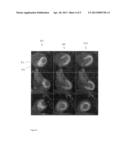 METHODS AND APPARATUS FOR ALIGNING SETS OF MEDICAL IMAGING DATA diagram and image