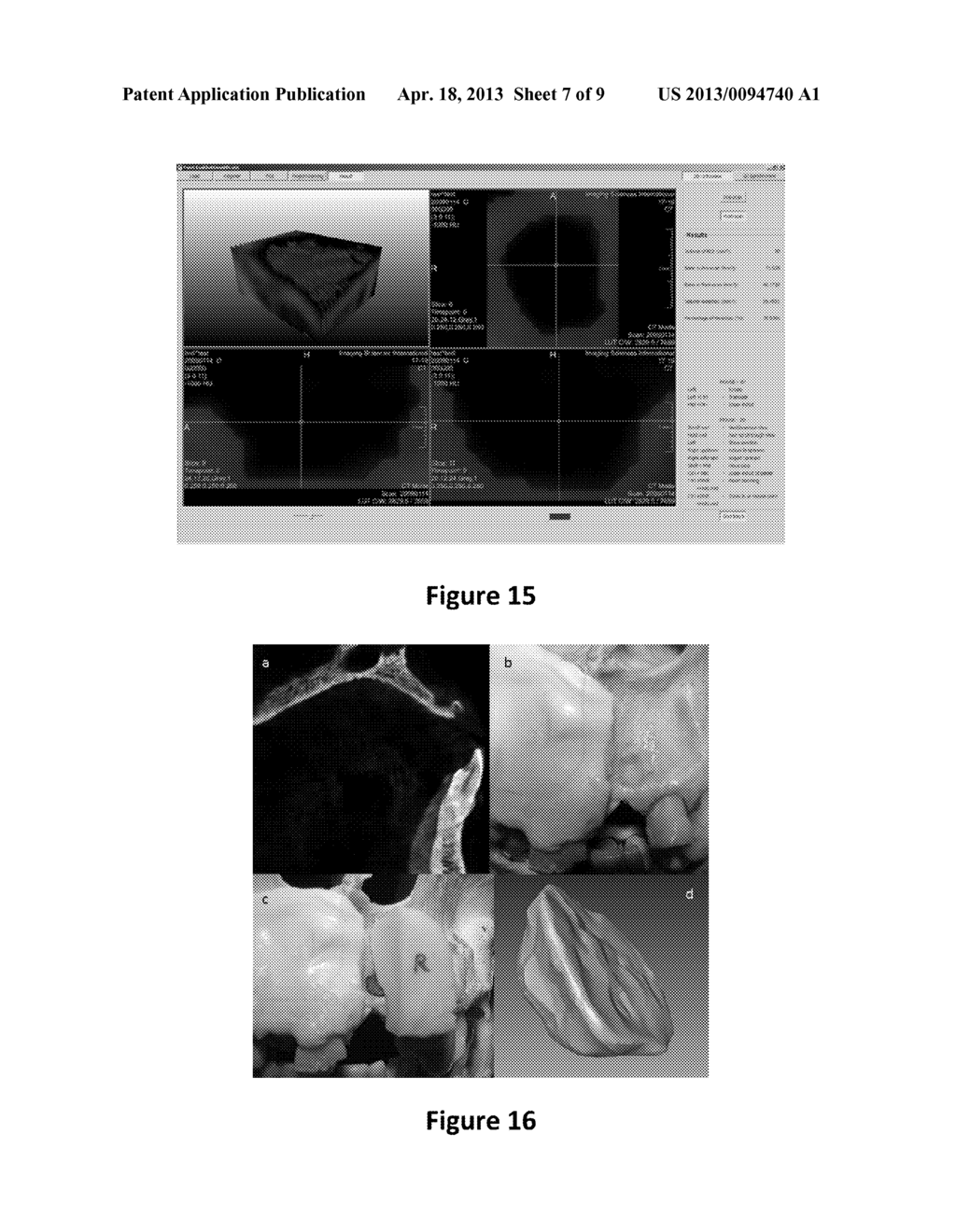 METHOD FOR QUANTIFYING LOCAL BONE CHANGES - diagram, schematic, and image 08