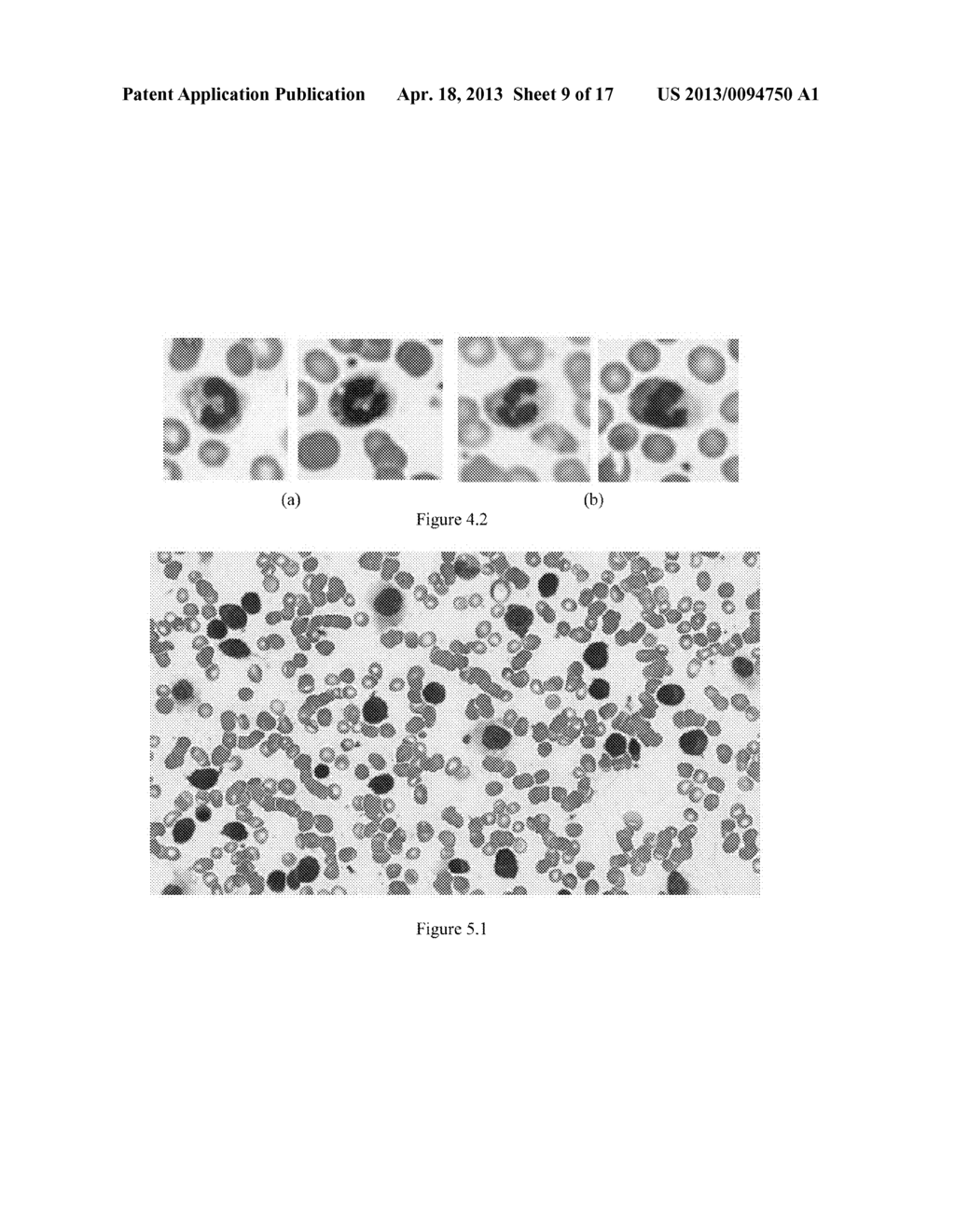 METHODS AND SYSTEMS FOR SEGMENTATION OF CELLS FOR AN AUTOMATED     DIFFERENTIAL COUNTING SYSTEM - diagram, schematic, and image 10