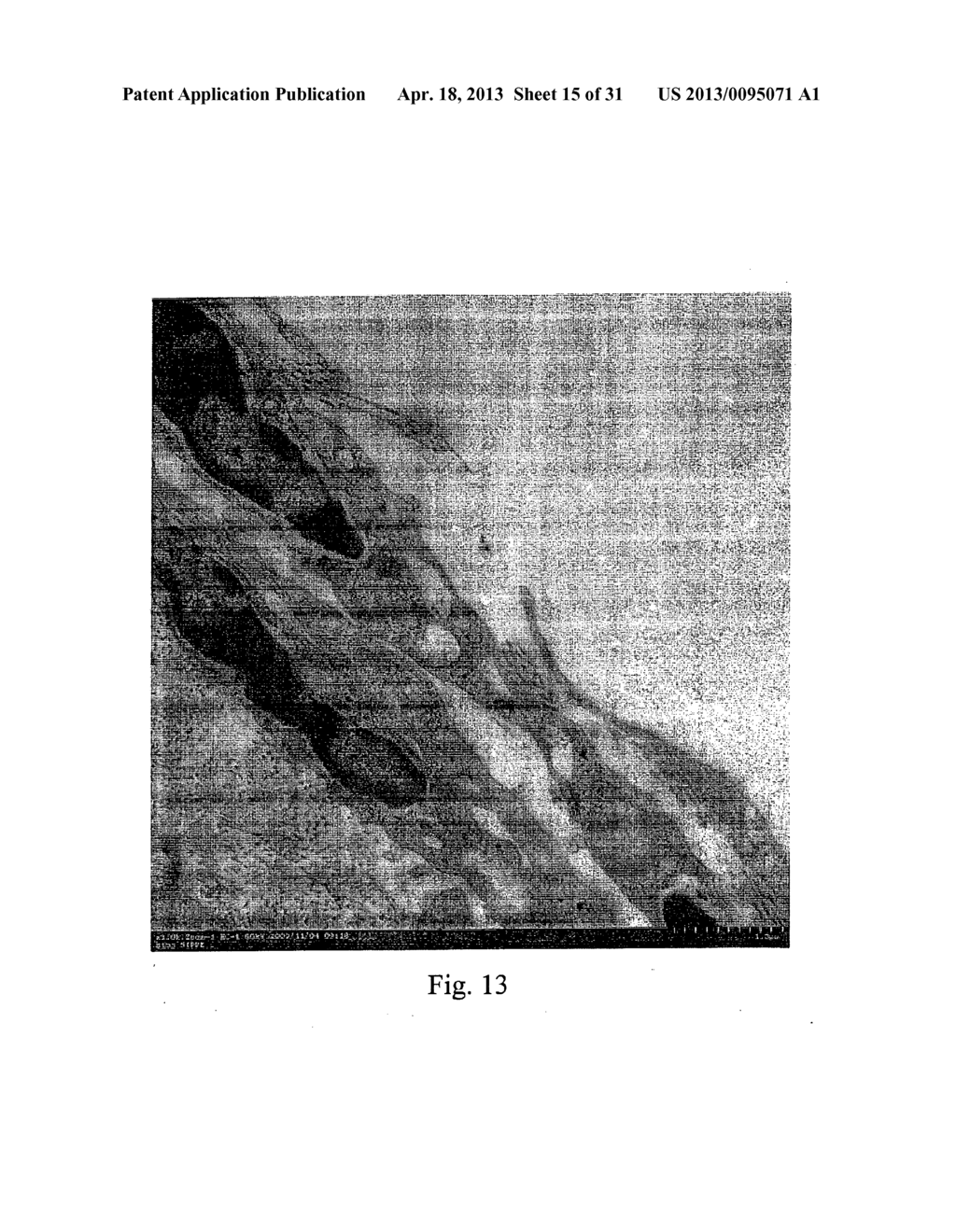 METHOD OF TREATING OR PREVENTING HEARING LOSS - diagram, schematic, and image 16