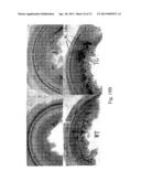 METHOD OF TREATING OR PREVENTING HEARING LOSS diagram and image
