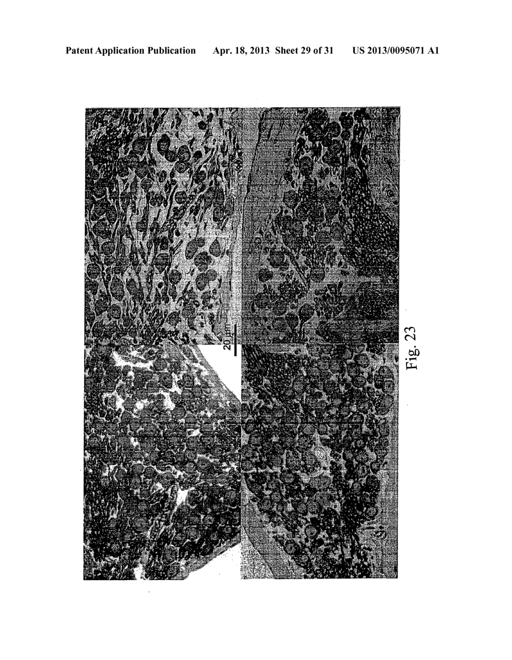 METHOD OF TREATING OR PREVENTING HEARING LOSS - diagram, schematic, and image 30