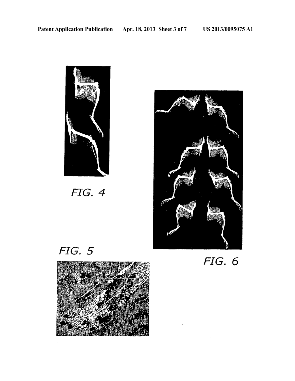 BONE MORPHOGENIC PROTEIN BINDING PEPTIDE - diagram, schematic, and image 04