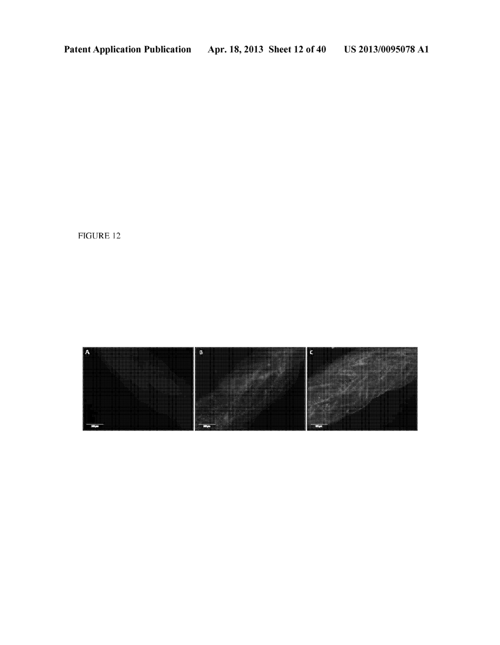 METHODS FOR REGENERATING SKELETAL MUSCLE - diagram, schematic, and image 13