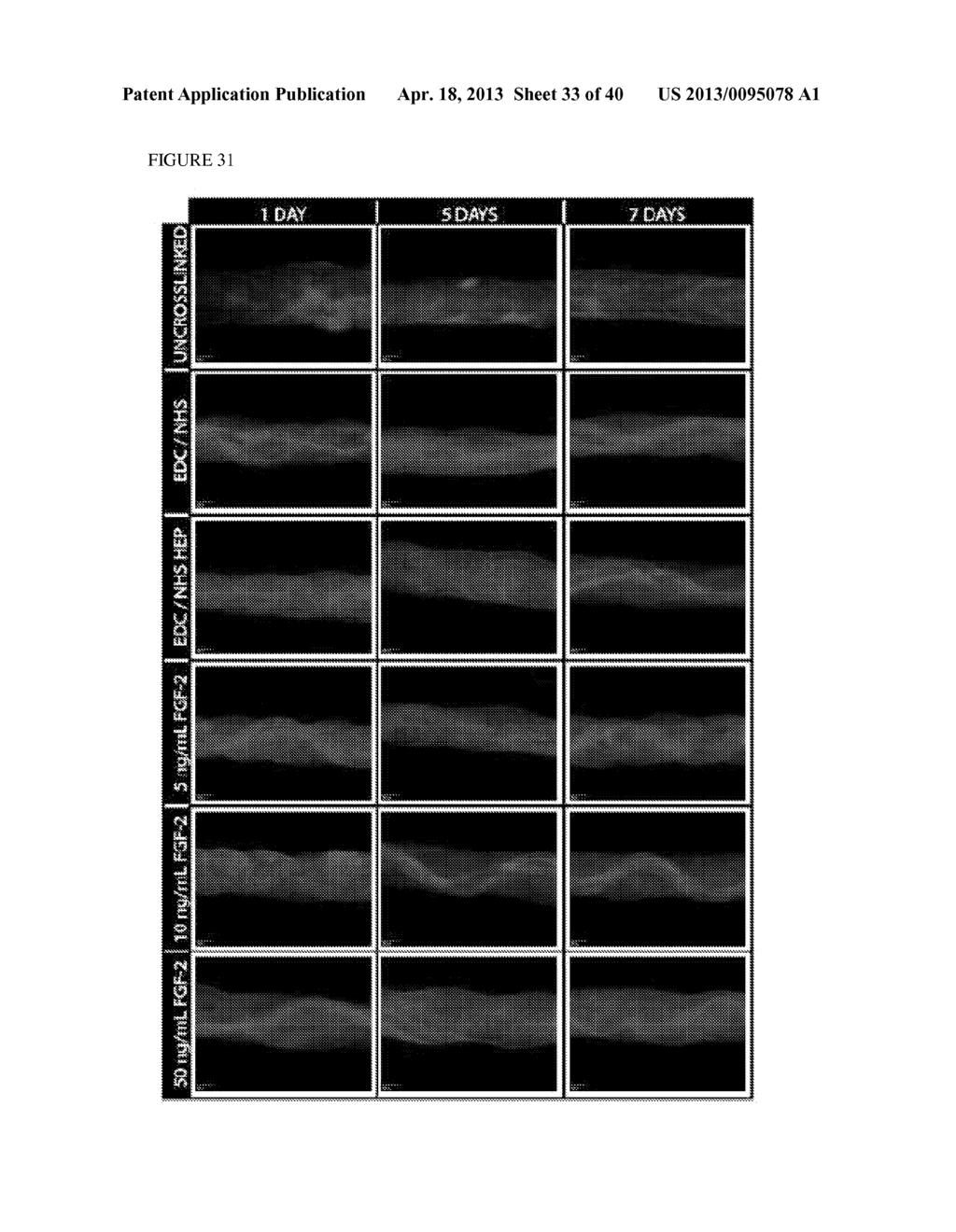 METHODS FOR REGENERATING SKELETAL MUSCLE - diagram, schematic, and image 34