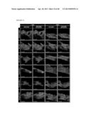 METHODS FOR REGENERATING SKELETAL MUSCLE diagram and image