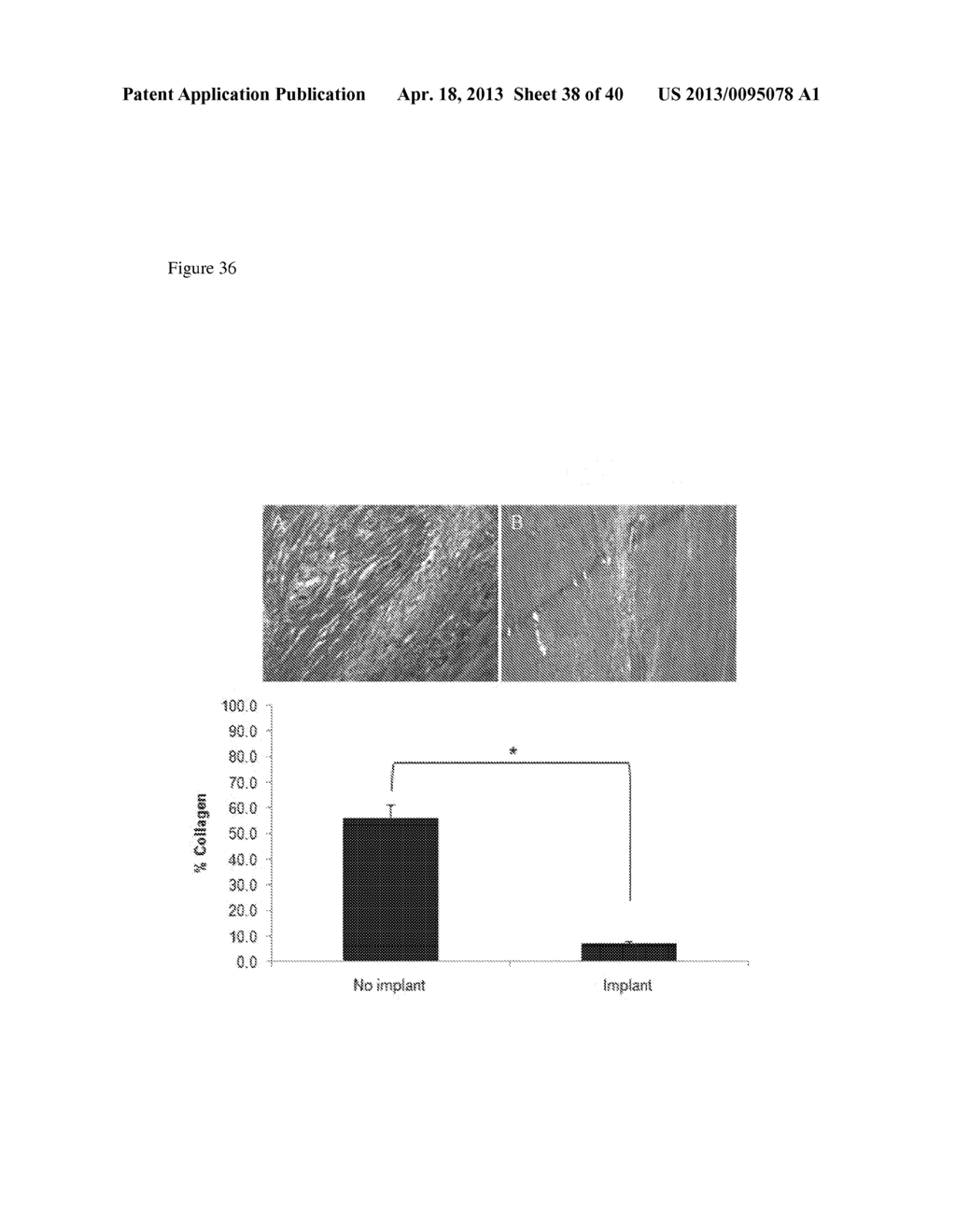 METHODS FOR REGENERATING SKELETAL MUSCLE - diagram, schematic, and image 39