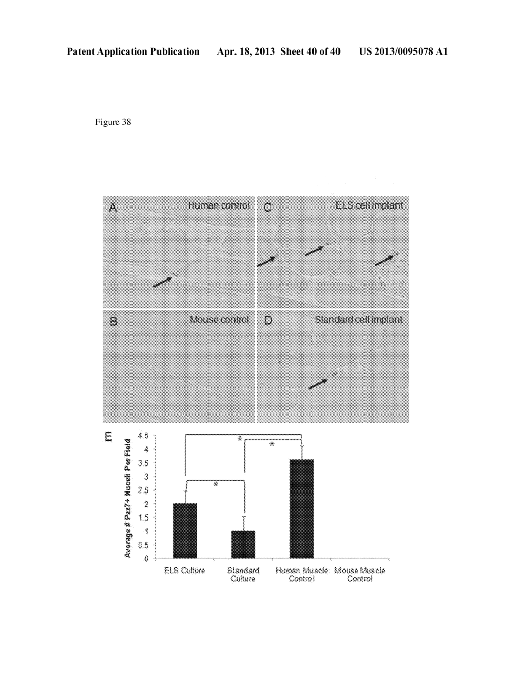 METHODS FOR REGENERATING SKELETAL MUSCLE - diagram, schematic, and image 41