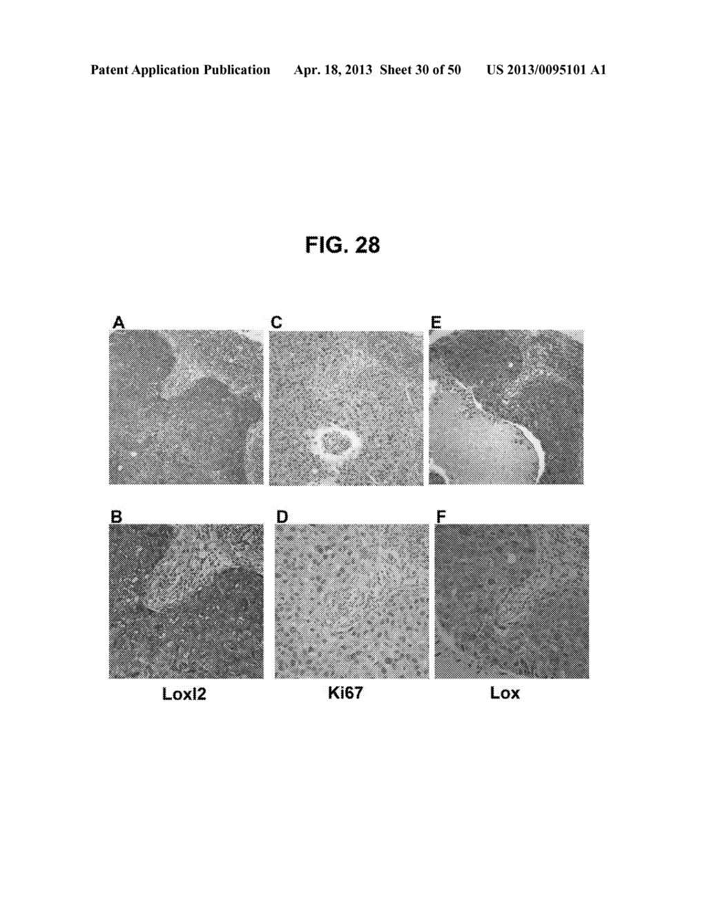 METHODS AND COMPOSITIONS FOR TREATMENT AND DIAGNOSIS OF FIBROSIS, TUMOR     INVASION, ANGIOGENESIS, AND METASTASIS - diagram, schematic, and image 31