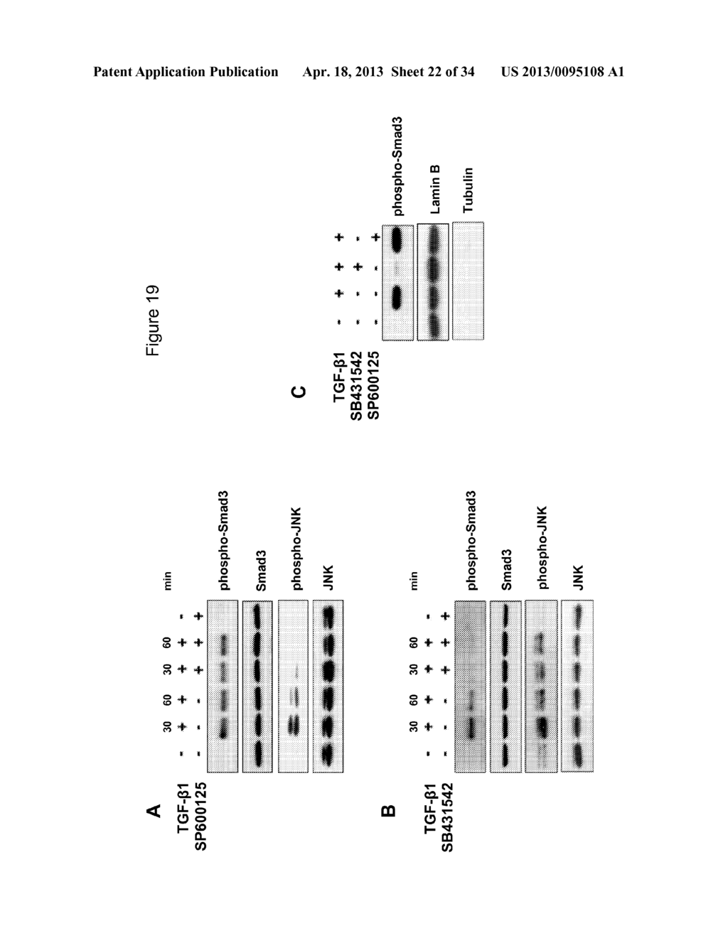 FACTOR XII INHIBITORS FOR TREATING INTERSTITIAL LUNG DISEASE - diagram, schematic, and image 23