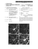COMPOSITIONS AND METHODS FOR TREATING NEUROLOGICAL DISORDERS diagram and image