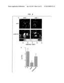 STAPHYLOCOCCUS AUREUS LEUKOCIDINS, THERAPEUTIC COMPOSITIONS, AND USES     THEREOF diagram and image