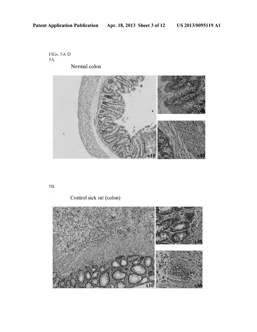 COMPOSITIONS AND METHODS FOR DIAGNOSING AND TREATING AN INFLAMMATION - diagram, schematic, and image 04