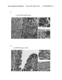 COMPOSITIONS AND METHODS FOR DIAGNOSING AND TREATING AN INFLAMMATION diagram and image