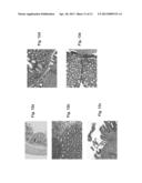 COMPOSITIONS AND METHODS FOR DIAGNOSING AND TREATING AN INFLAMMATION diagram and image