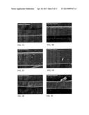 SOL-GEL DERIVED BIOACTIVE GLASS POLYMER COMPOSITE diagram and image