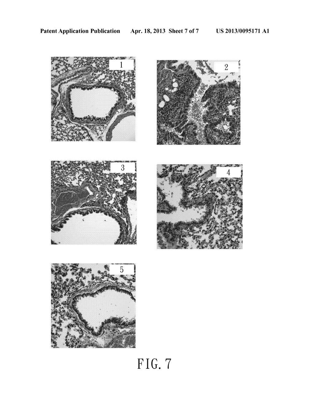 HERBAL COMPOSITION AND METHOD FOR TREATMENT OF AIRWAY INFLAMMATION USING     THE SAME - diagram, schematic, and image 08