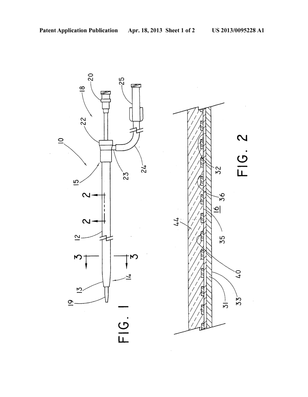 INTRODUCER SHEATH WITH ENCAPSULATED REINFORCING MEMBER - diagram, schematic, and image 02